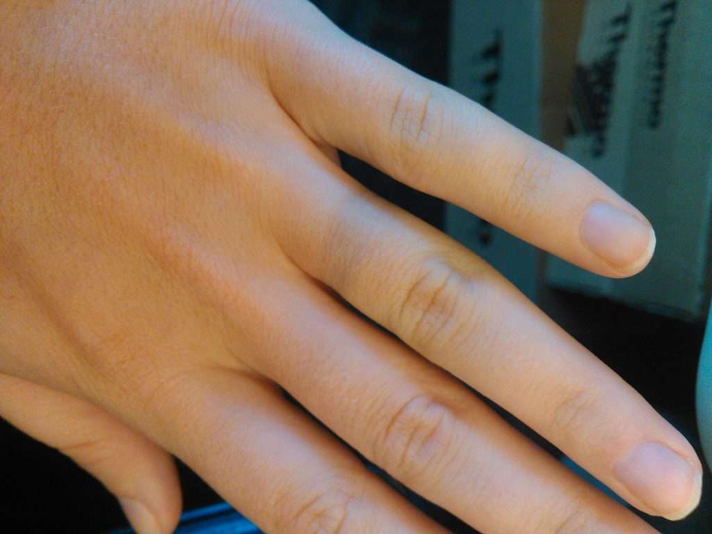 Green Skin from Jewelry